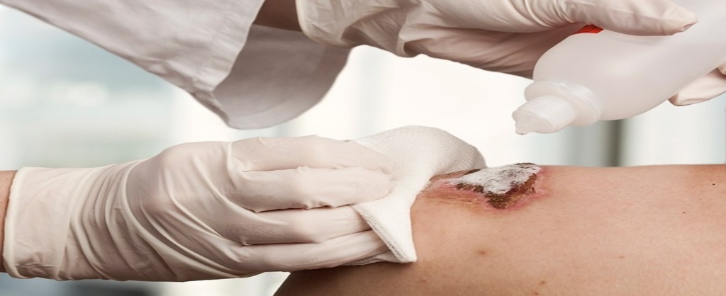  Curación Avanzada de Heridas - Presencial